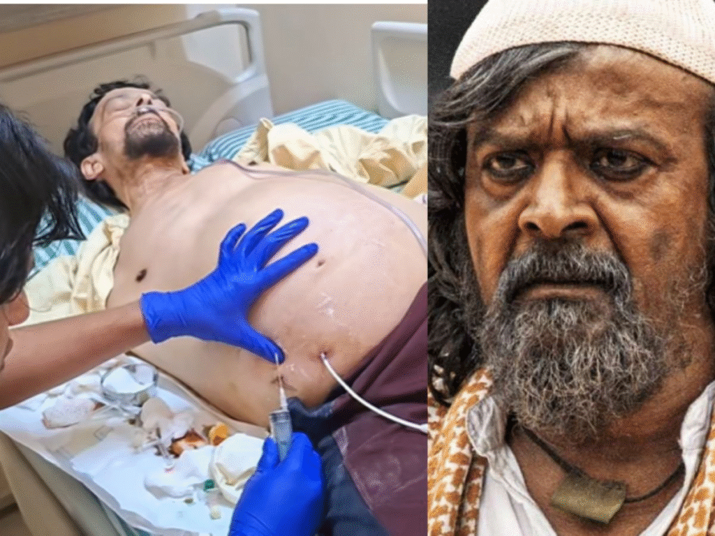 Harish Rai Death: KGF Actor's Final Video Goes Viral As Cancer Battle Ends